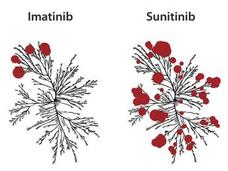 Kinome trees with circles representing potency of binding for four targeted TKIs.