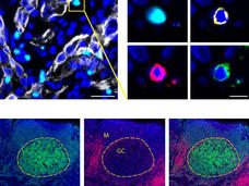 Images of different fluorescing cells around tumors.