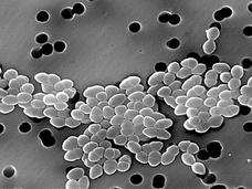 A scanning electron microscope image of a cluster of vancomycin-resistant Enterococci sp. bacteria.