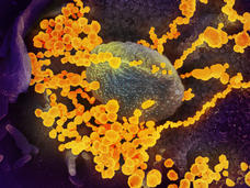 Microscope image of gold-colored virus particles