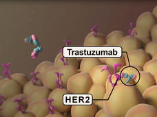 graphic shows Trastuzumab, a monoclonal antibody, attaching to HER2 on the surface of cancer cells