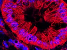 This image shows mitochondrial staining (red) and nuclear staining (blue) of abnormal pancreatic ducts from a mouse model of human pancreatic ductal carcinoma. 