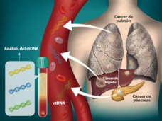 Imagen en la que se observa el ADN que se separa de los tumores y circula en la sangre.