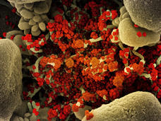 Imagen molecular del SARS-CoV-2