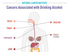 Cancers Associated with Drinking Alcohol Infographic