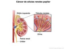 En la imagen se observan el riñón izquierdo, la pelvis renal y el uréter. En una ampliación, también se muestran los túbulos renales que producen la orina.