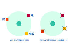 2 circles representing breast cancer cells, one triple-negative breast cancer and the other most breast cancer cells. The triple-negative breast cancer cells don't have estrogen receptors (ER), progesterone receptors (PR), or large amounts of the HER2 protein on their surface.