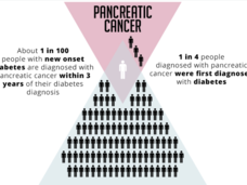 Infographic showing that 1 in 100 people with new-onset diabetes are diagnosed with pancreatic cancer within 3 years. And 1 in 4 people diagnosed with pancreatic cancer were first diagnosed with diabetes.