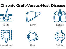 Text reading chronic graft-versus-host disease, followed by icons of six organs-skin, liver, lungs, intestines, eyes, and joints.