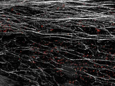 Image of white fiber structures and red cells on black background