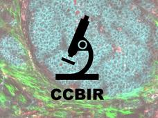 Representative image for the Cellular Cancer Biology Imaging Research (CCBIR) of a image of the tumor microenvironment overlayed with a microscope.