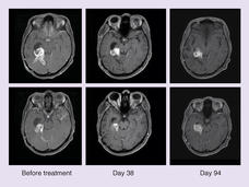 MRI image