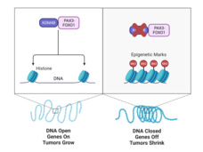 KDM4B paired with PAX3-FOXO1 opens DNA, turns genes on, causing tumors to grow. When KDM4B is blocked, DNA closes, genes turn off, causing tumors to shrink.