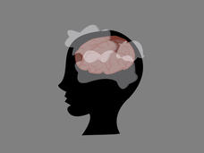 A cartoon silhouette of a woman's head with white and pink cloud-like shapes over her brain. 