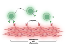 At the bottom, several layers of heart muscle cells with inflammation. Alpha-myosin protiens project like fingers along the top of the heart muscle cells. T cells float above the alpha-myosin projections and bind to them.