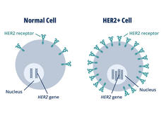 An illustration showing two cancer cells side by side with different amounts of HER2 on its surface.