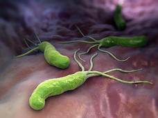 Imagen de la bacteria Helicobacter pylori (H. pylori).
