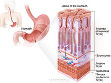 Layers of the stomach wall; drawing of the stomach with an inset showing the layers of the stomach wall, including the mucosa (innermost layer), submucosa, muscle layer, subserosa, and serosa (outermost layer).