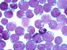 Hematoxylin and eosin (HE) staining of the Epstein-Barr virus (EBV).