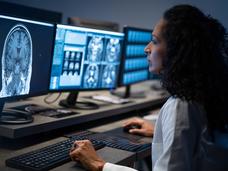 Health care worker examining MRI brain scan