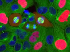 NIH study offers insights into how cells reverse their decision to divide