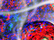 High-Risk Papilloma Cells overlaid with a wisp of smoke