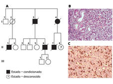 Imagen con tres partes: la parte A muestra la genealogía familiar, las partes B y C son imágenes de tejido celular con cáncer gástrico.