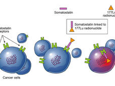 Somatostatin linked to 177Lu receptors on cancer cells.