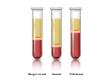Ilustración de tres tubos de ensayo con sangre que contienen capas de plasma, leucocitos y plaquetas, y glóbulos rojos. Los tubos muestran los componentes sanguíneos normal