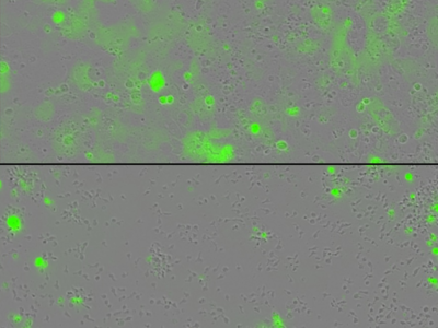 En la imagen de arriba, se observan abundantes células tumorales en color verde. En la imagen de abajo, se observan muchas menos células tumorales en color verde.