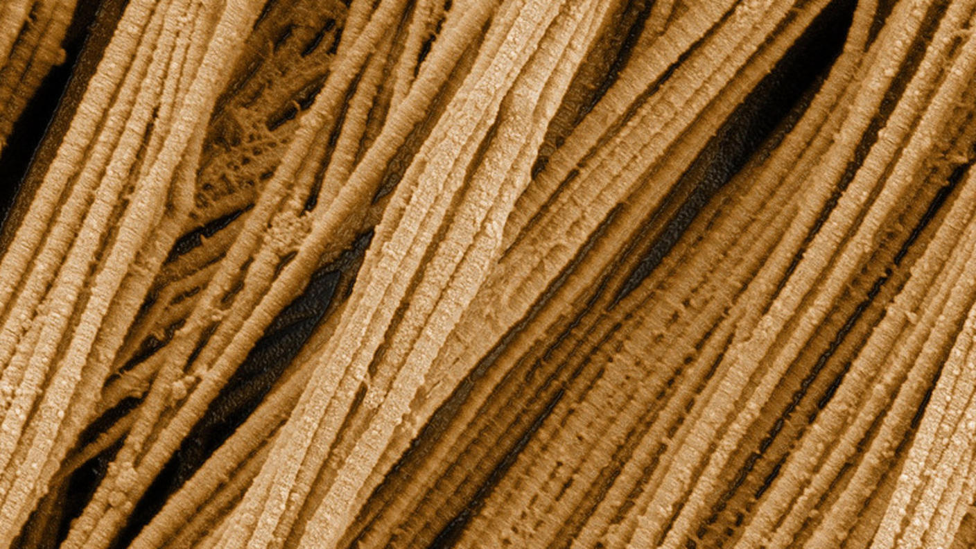 Scanning electron microscopy image of ropelike collagen fibers.