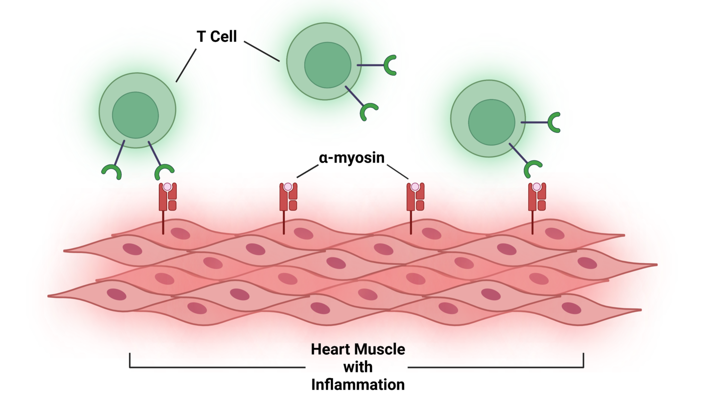An illustration of T cells attacking inflamed heart tissue by binding to alpha-myosin.