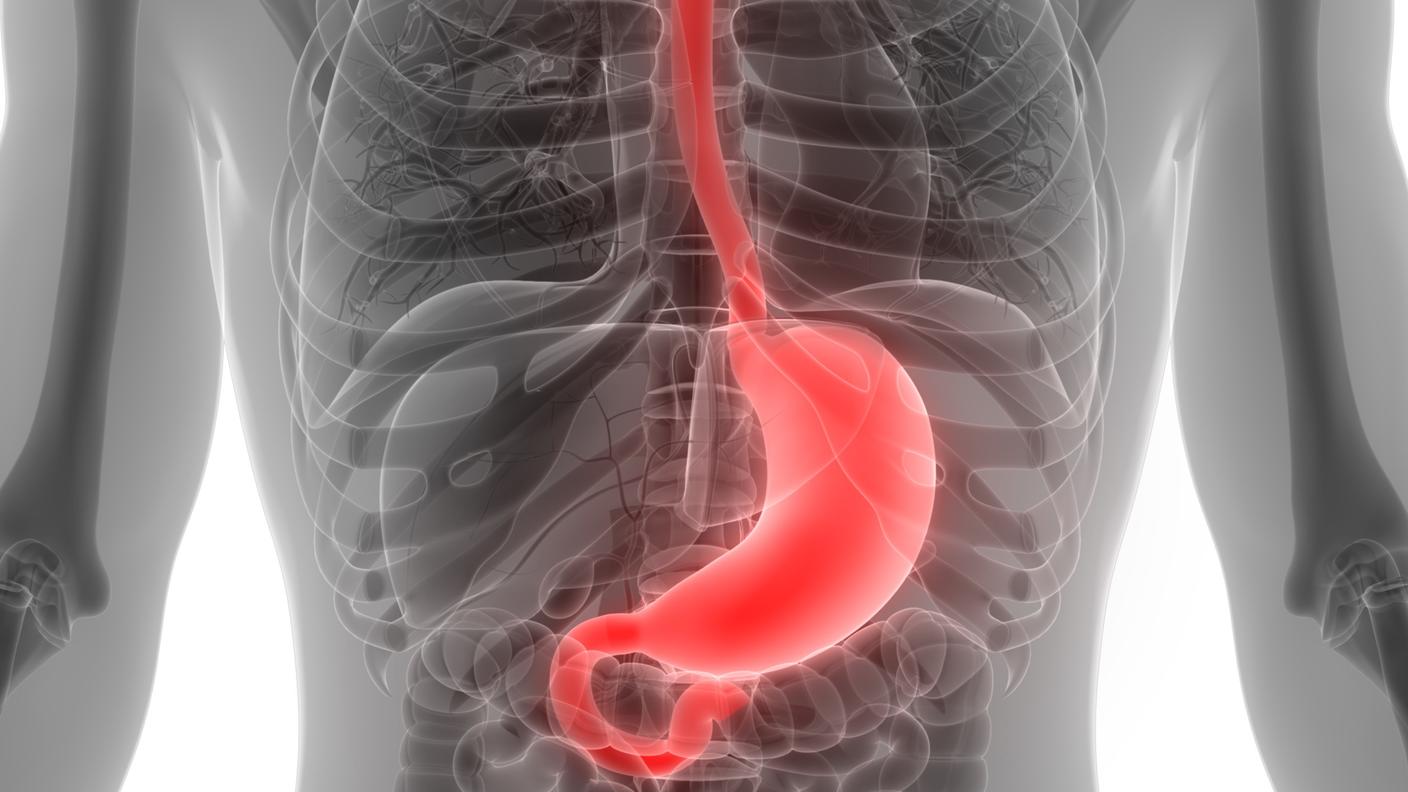 A conceptual imaging scan of a chest with the esophagus and stomach highlighted in red
