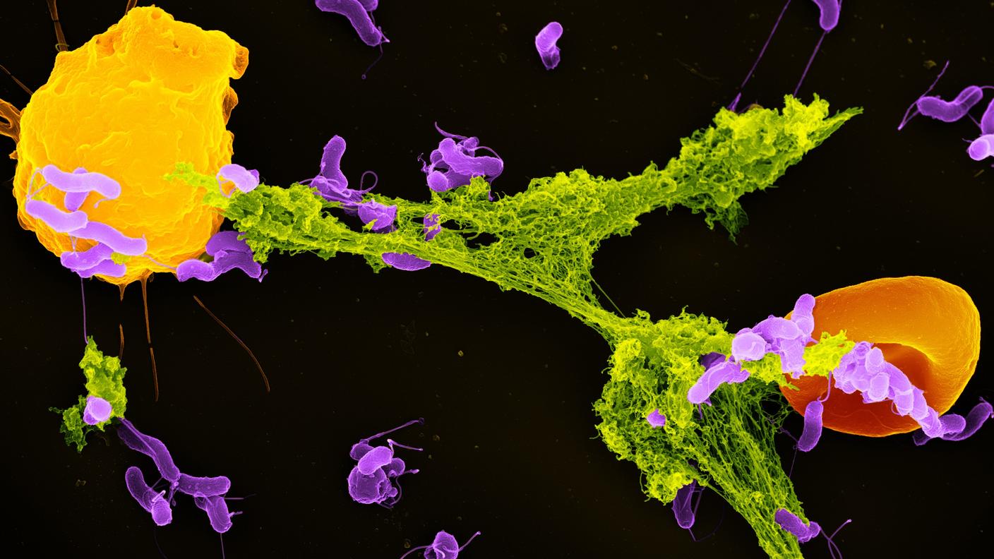 An electron microscope image of a neutrophil ejecting a NET that has captured bacteria