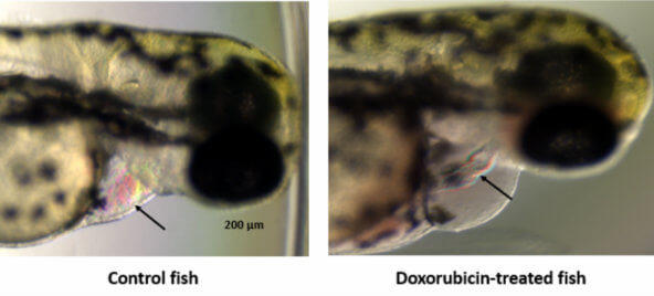 Microscopic image of a normal fish (left) and a fish that developed cardiomyopathy after treatment with doxorubicin (right).
