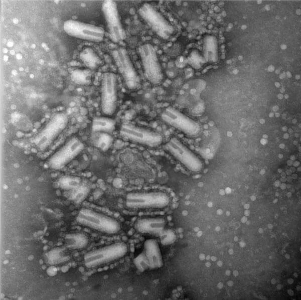 A black and white microscopic image of the Maraba virus. It is mainly composed of cylindrical shapes with lines running through part of the cylinders. Small dots surround the exteriors of the cylinders. The background has small dots scattered throughout with various parts that are darker and lighter grey.