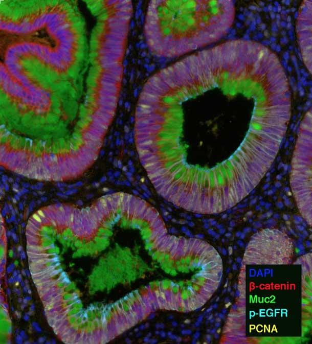 A fluorescent microscopy image of tissue sections shows intricate patterns of cells and structures in vibrant colors. Various markers are highlighted: blue for DAPI (nuclei), red for β-catenin, green for Muc2, yellow-green for p-EGFR, and yellow for PCNA, as indicated in the color key. The different colors represent specific proteins and cellular components.