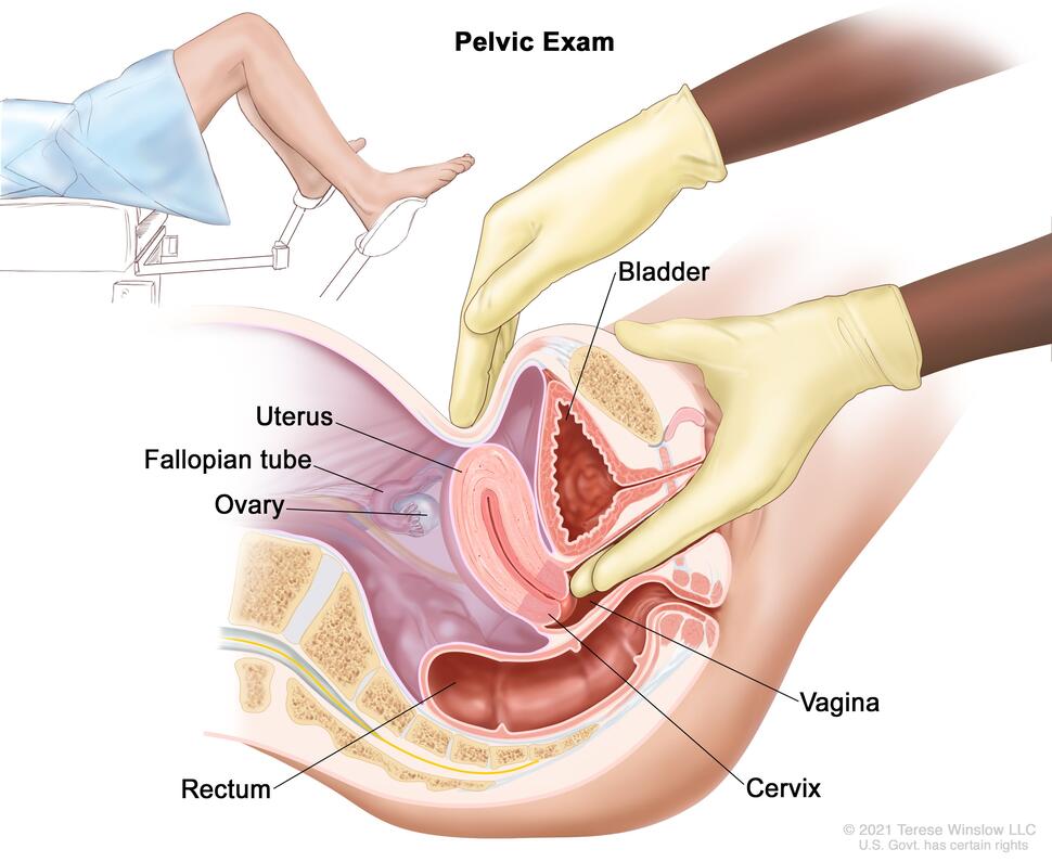 Examen pélvico. En la imagen se muestra una vista lateral anatómica del aparato reproductor femenino durante un examen pélvico. 