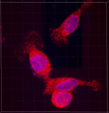Fluorescent microscopy image showing three cells with NOS2 expression after treatment, displaying bright pink/purple nuclei surrounded by red staining indicating NOS2 protein distribution in the cellular structures.