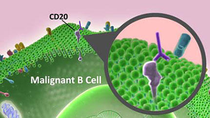 Scientific illustration of rituximab antibodies (purple) binding to CD20 proteins on a malignant B cell (green)