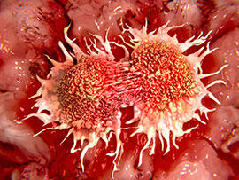 Microscopic image of a cancer cell in the process of dividing into two cells
