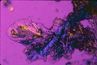 Microscopic image of cisplatin crystals showing the crystals' characteristic dark branching structure against a purple background.