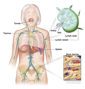 Illustration of the human lymphatic system. It shows a female figure with labels for tonsils, thymus, spleen, lymph nodes, and vessels. One inset shows a detailed lymph node diagram and another inset shows a close-up of bone marrow.