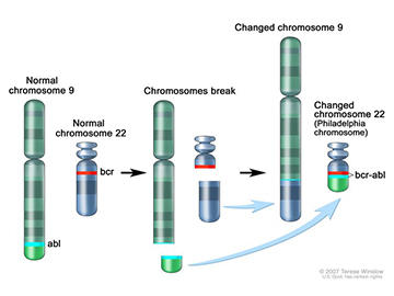Illustration of chromosomal translocation involving chromosomes 9 and 22, showing chromosomal breaking and exchange, that results in the Philadelphia chromosome. The illustration highlights the abl gene on chromosome 9 and the bcr gene on chromosome 22, which form the bcr-abl fusion on the altered chromosome 22.