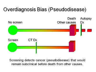 Diagram illustrating overdiagnosis bias (pseudodisease), comparing two scenarios - one where cancer is not detected by screening and the person dies from other causes, and another where screening detects cancer that would not have been clinically significant before natural death, demonstrating how screening can identify cancers that wouldn't have caused symptoms or death.