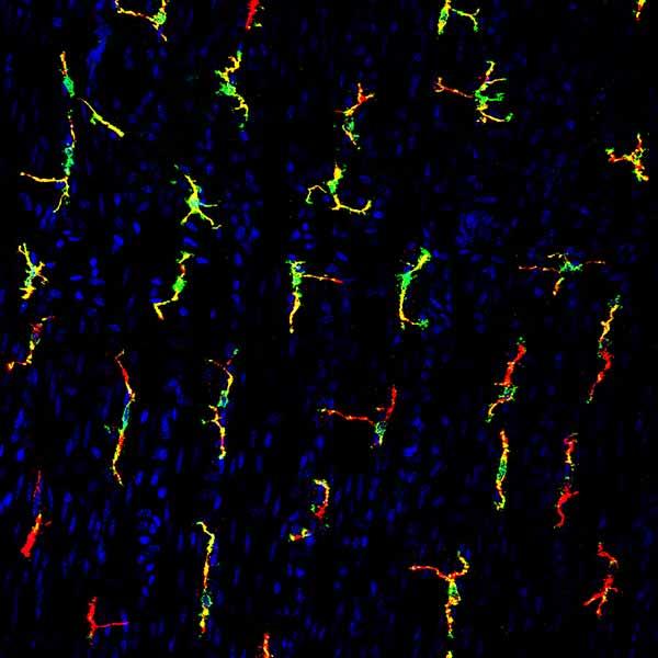 Fluorescent microscopy image showing a receptor (green) on immune cells called macrophages (red).