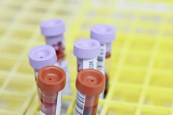 Blood collection tubes with colored caps (purple and red-orange) in laboratory test tube rack.