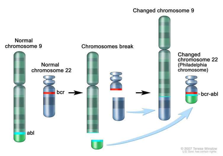 Illustration of chromosomal translocation involving chromosomes 9 and 22, showing chromosomal breaking and exchange, that results in the Philadelphia chromosome. The illustration highlights the abl gene on chromosome 9 and the bcr gene on chromosome 22, which form the bcr-abl fusion on the altered chromosome 22.