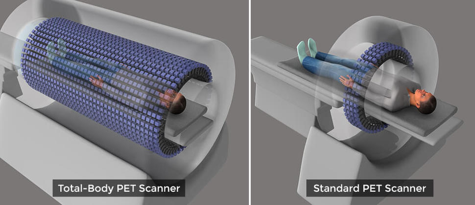 Diagram showing a full-body PET scan and a standard PET scan.