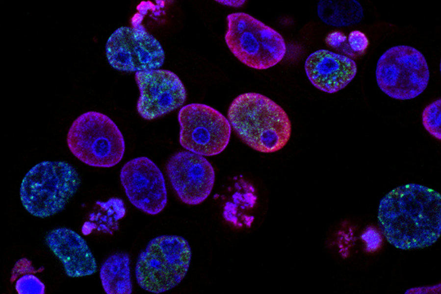 Photo of cells with treatment-induced DNA damage, marked by red staining